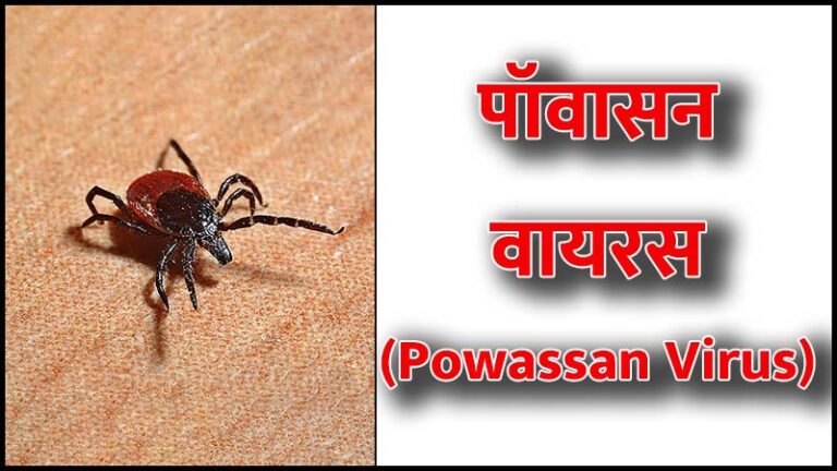पॉवासन वायरस क्या है? (What is Powassan virus in Hindi)